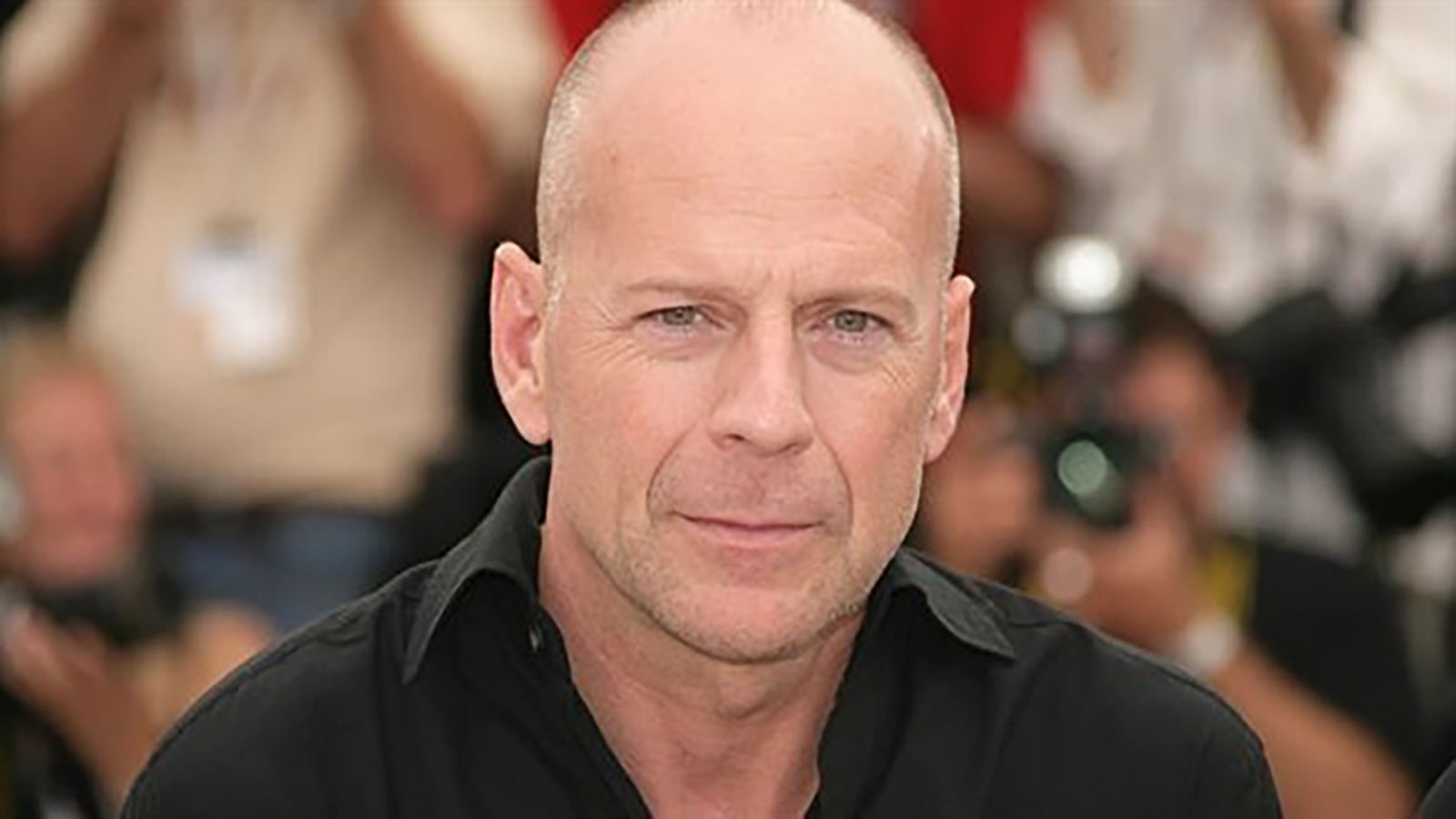 إصابة بروس ويليس بمرض الخرف الجبهي الصدغي