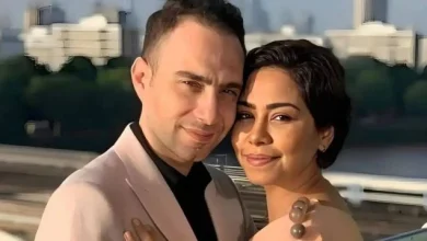 تسريب صورة للفانة شيرين عبدالوهاب بعد ضرب حسام حبيب لها